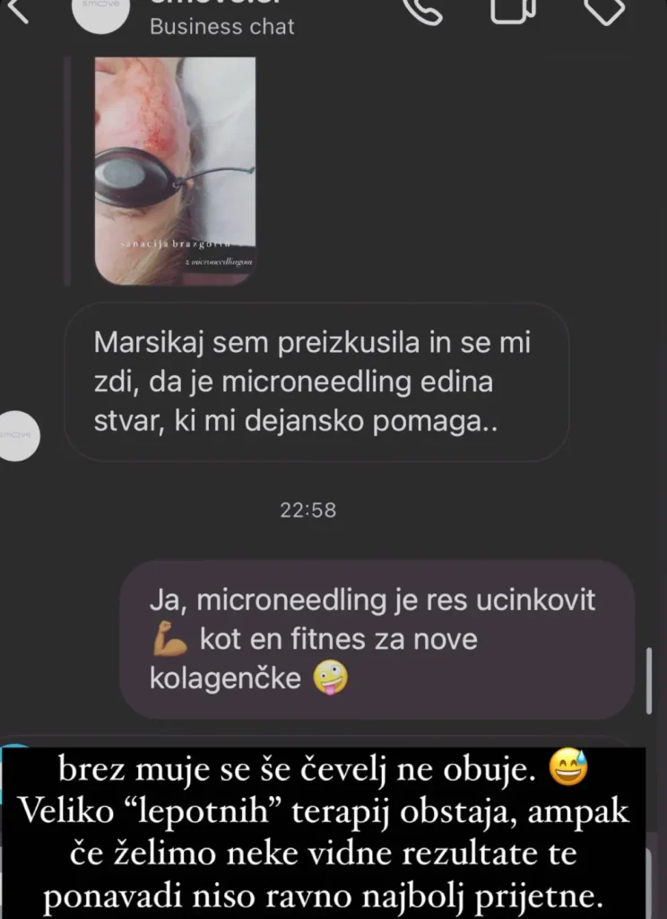 microneedling cena posvet kozmetični salon Ljubljana