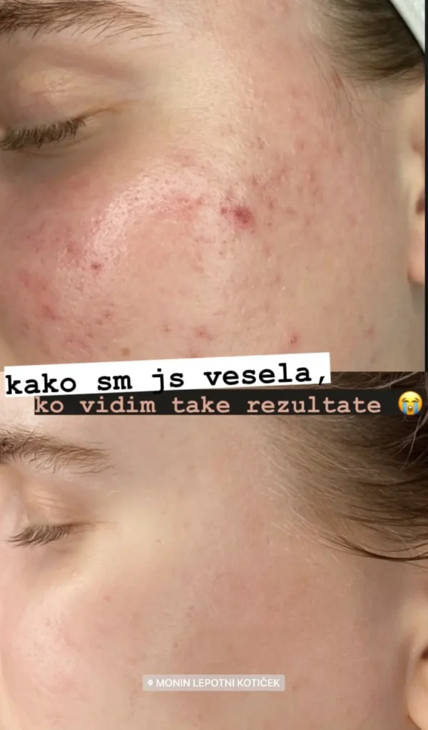nega obraza ljubljana kozmetični salon monin kotiček