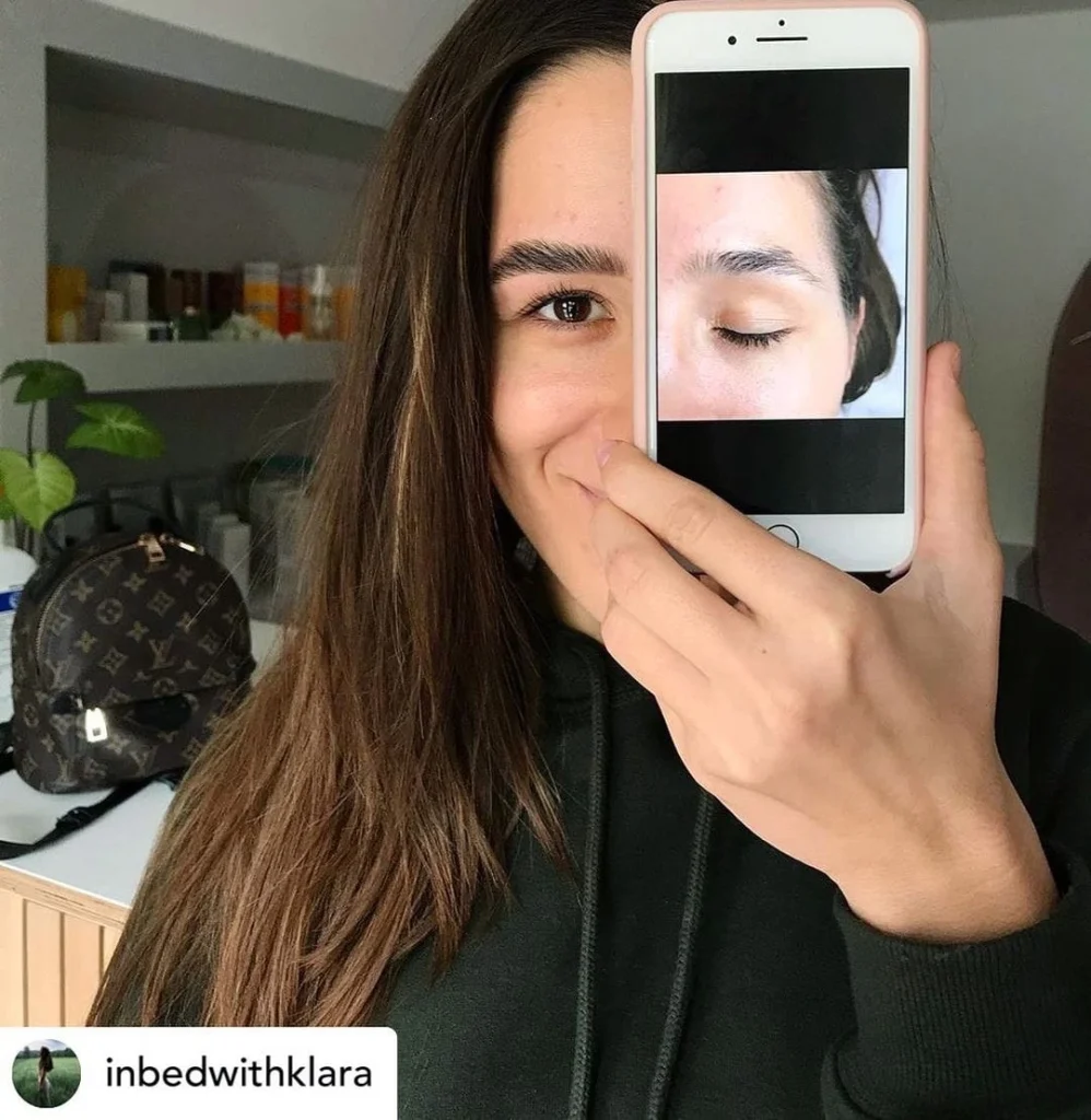 Laminacija obrvi Ljubljana